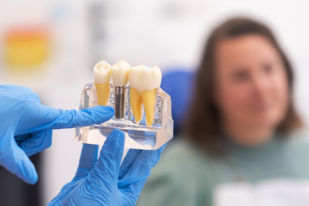 dentist in blue gloves showing dental implant model to patient at Encinitas Dental Art in Encinitas, CA